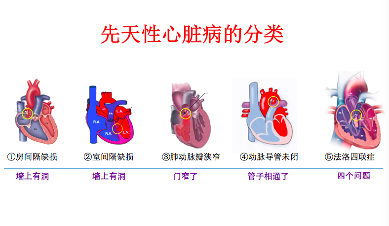 先心病的各种类型 图/受访者提供