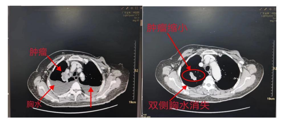 截屏2023-07-05 09.59.53.png