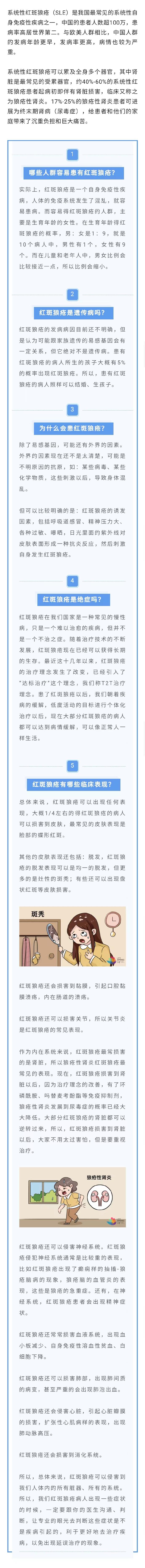 冲上热搜的红斑狼疮是如何患上的？晒太阳、压力大……都是诱发因素