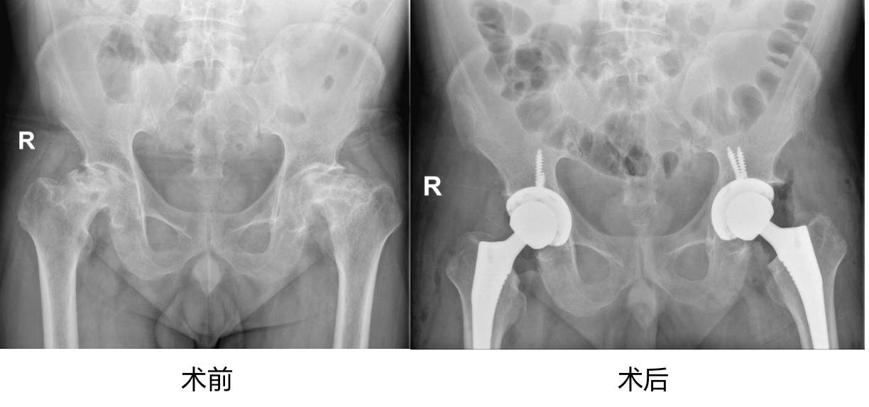 网球肘的症状和发病原因图片 52837685_eeb2d21d-b527-44c6-880f-d4d0b34e6460copy.jpg