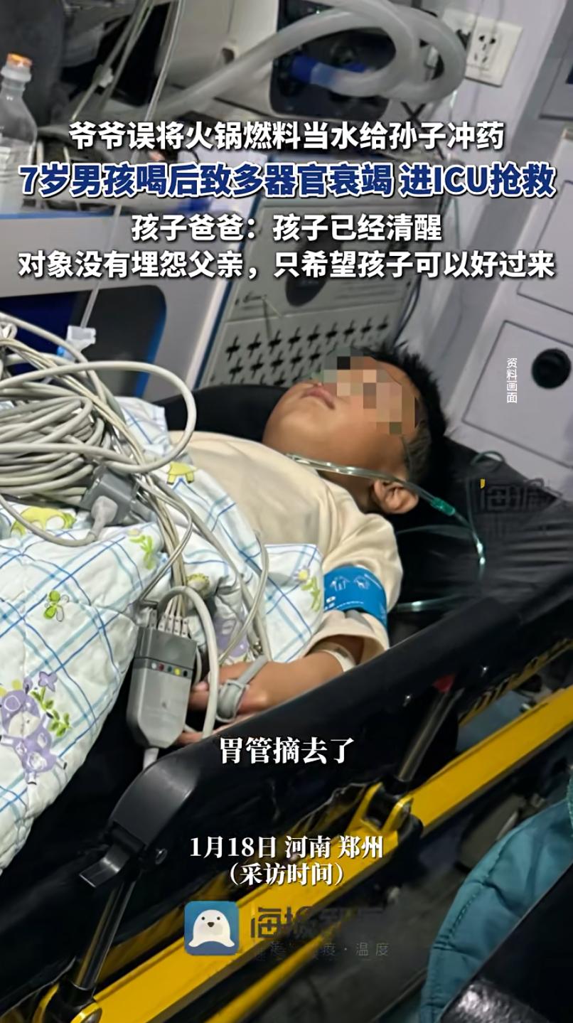 误喝火锅燃料的男孩醒来了，但情况仍不乐观